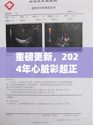 重磅更新，2024年心脏彩超正常值解读，你的心脏健康标准已出炉！