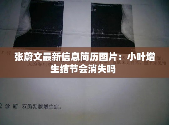 张蔚文最新信息简历图片:小叶增生结节会消失吗