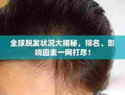 全球脱发状况大揭秘,排名、影响因素一网打尽!