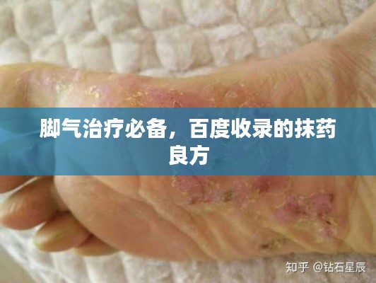 脚气治疗必备,百度收录的抹药良方