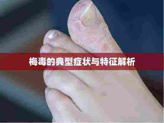 梅毒的典型症状与特征解析