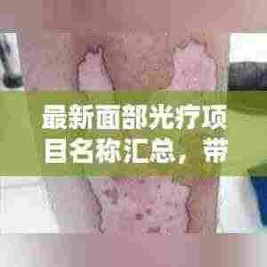 最新面部光疗项目名称汇总,带你了解最前沿的美容科技